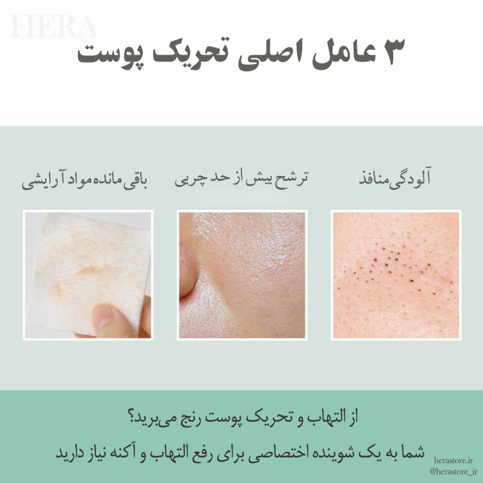  فوم شستشوی لایه بردار تی تریکا سنتلا SKIN 1004 